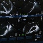 échographie du chien