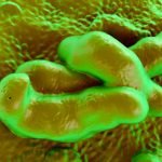 la campylobactériose du chien